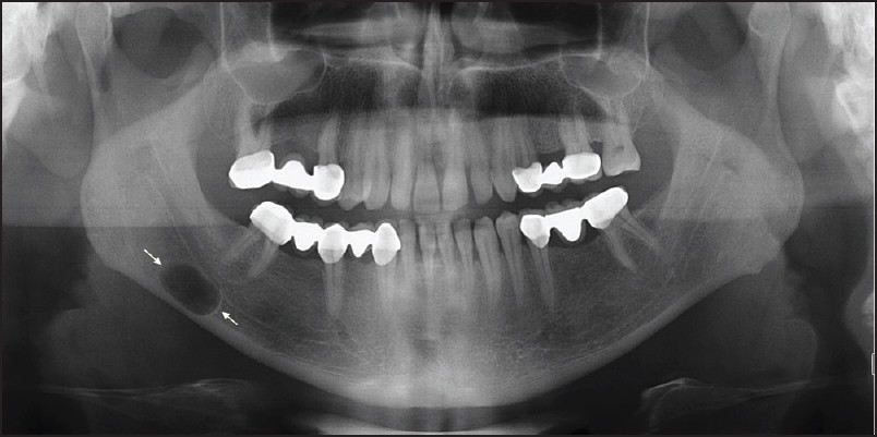 Oral Diagnoz ve Radyoloji